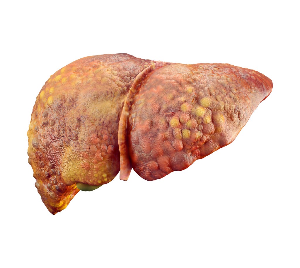 How To Identify The Symptoms Of Fatty Liver