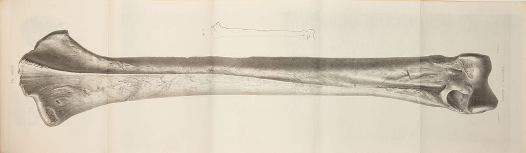 A large fold-out showing an illustration of a large bone