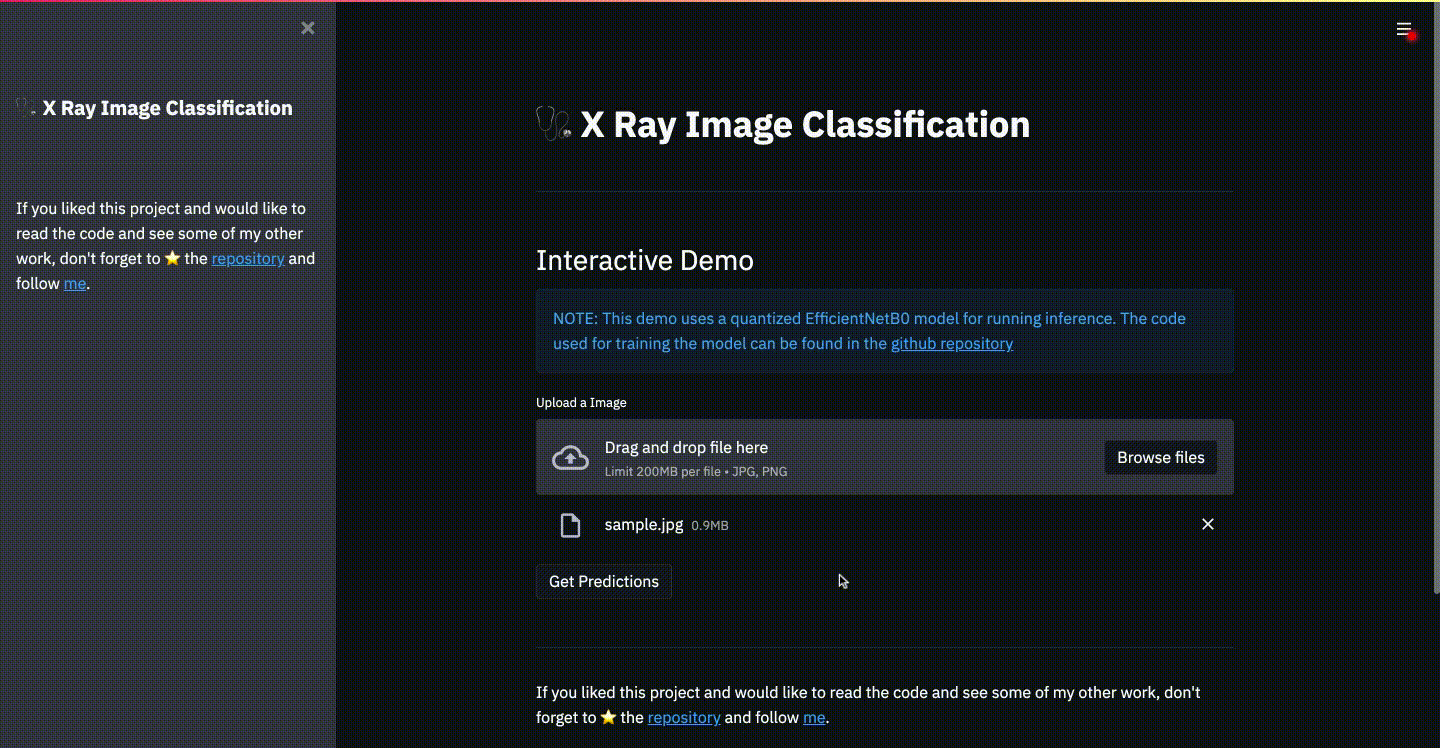 A gif demo of the streamlit x-ray classification app.