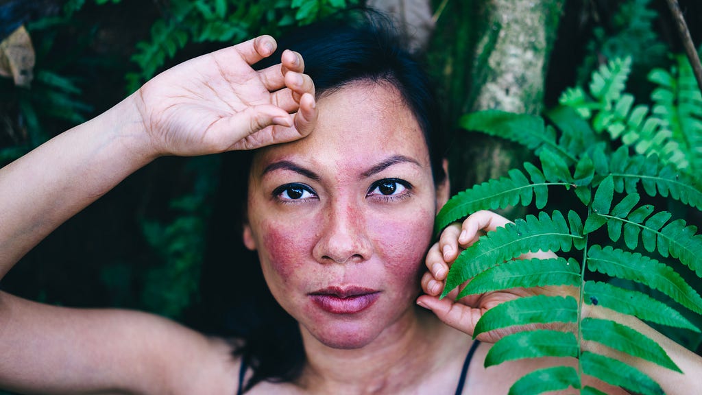 Rozella staring straight into the camera with the back of her right hand on her forehead, and her left hand touching a leaf next to her face