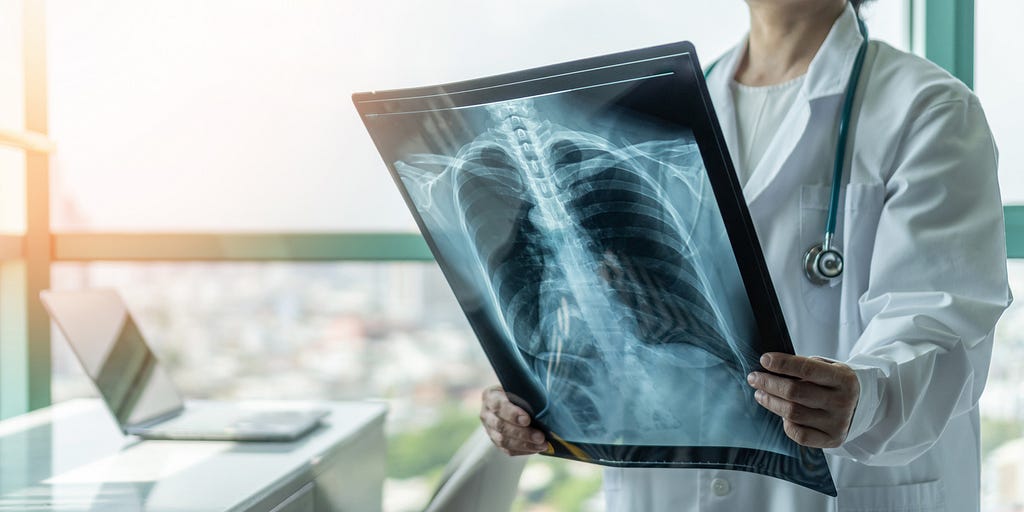 A doctor holding a scan of an x-ray