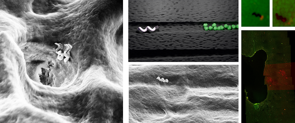 (Soldaki) Dentin tübülüne giren nano robotlar. (Ortadaki)Bakteri kolonisine ulaşmak için dentin tübülü boyunca hareket eden nanobotun şematik gösterimi ve elektron mikroskobu görüntüsü. (Sağdaki) Nanobottan yerel olarak üretilen ısının bakterileri nasıl öldürebildiği. Canlı bakteriler yeşil, ölü bakteriler ise kırmızıdır. Sağ altta insan dişlerinde hedefe yönelik tedavinin yapıldığı bant gösteriliyor