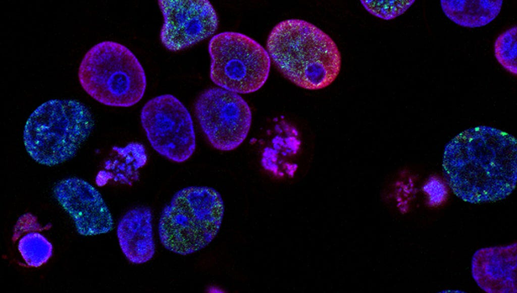 Purple cells