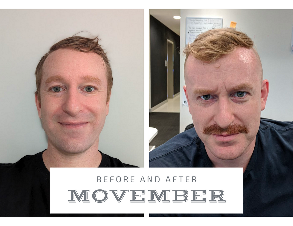 Before and After Movember