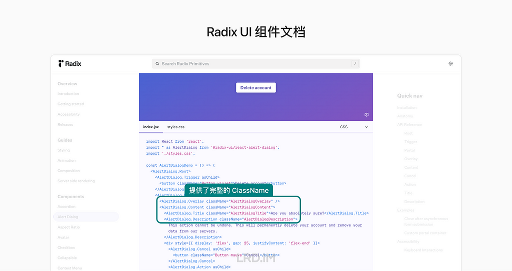 Radix UI 组件库的截图。展示了 Alert Dialog 组件的代码，并且用带有圆角的绿色方框高亮了代码中的四处 className。