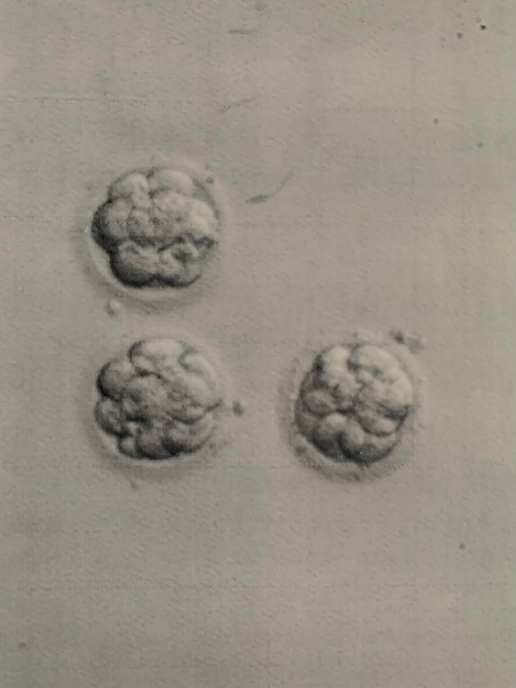 An image of three 16-cell blastocysts during a process of in vitro fertilization (IVF).