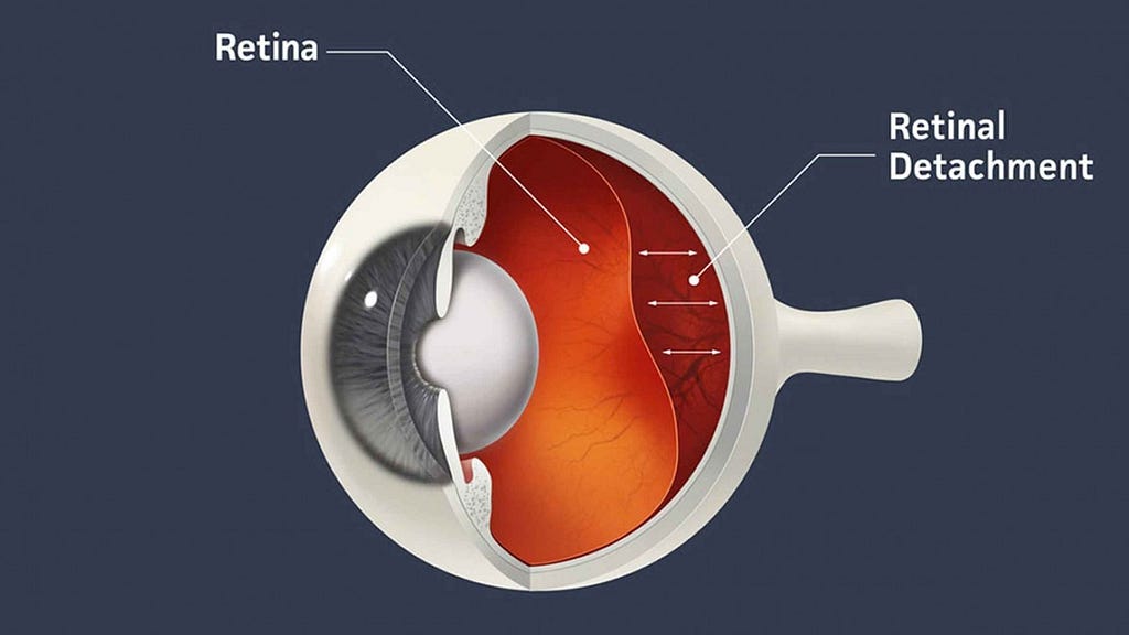 Best Retina Specialist in Mumbai