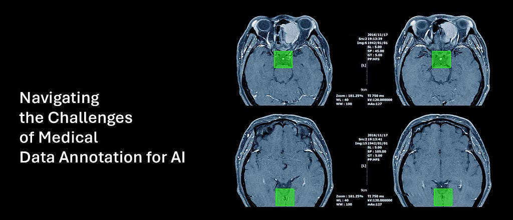 medical data annotation