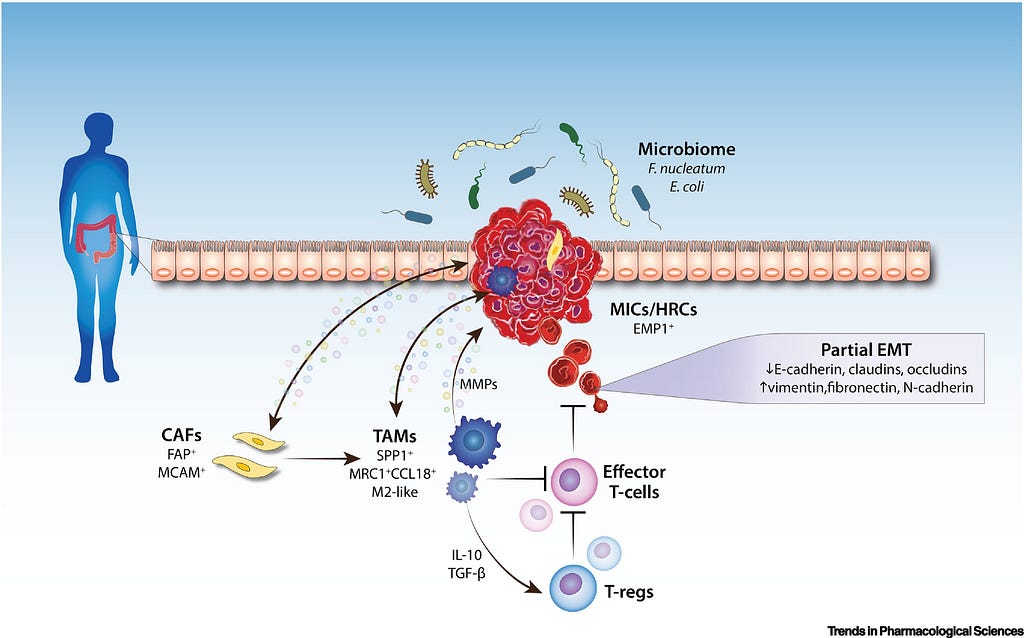 Metastatic Colorectal Carcinoma