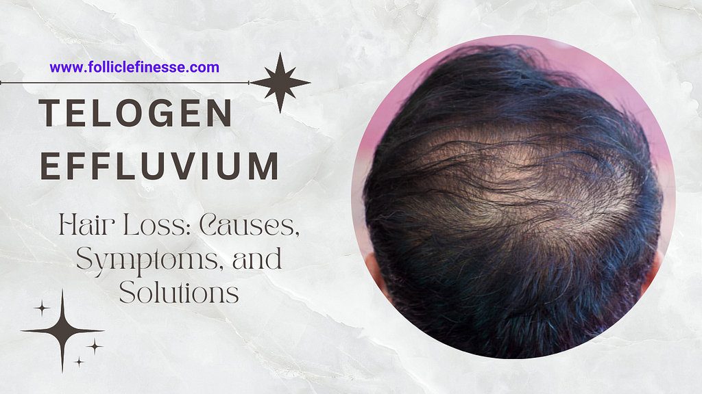 Telogen Effluvium Hair Loss: Causes, Symptoms, and Solutions