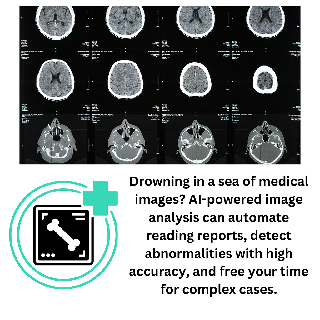 AI in Radiology