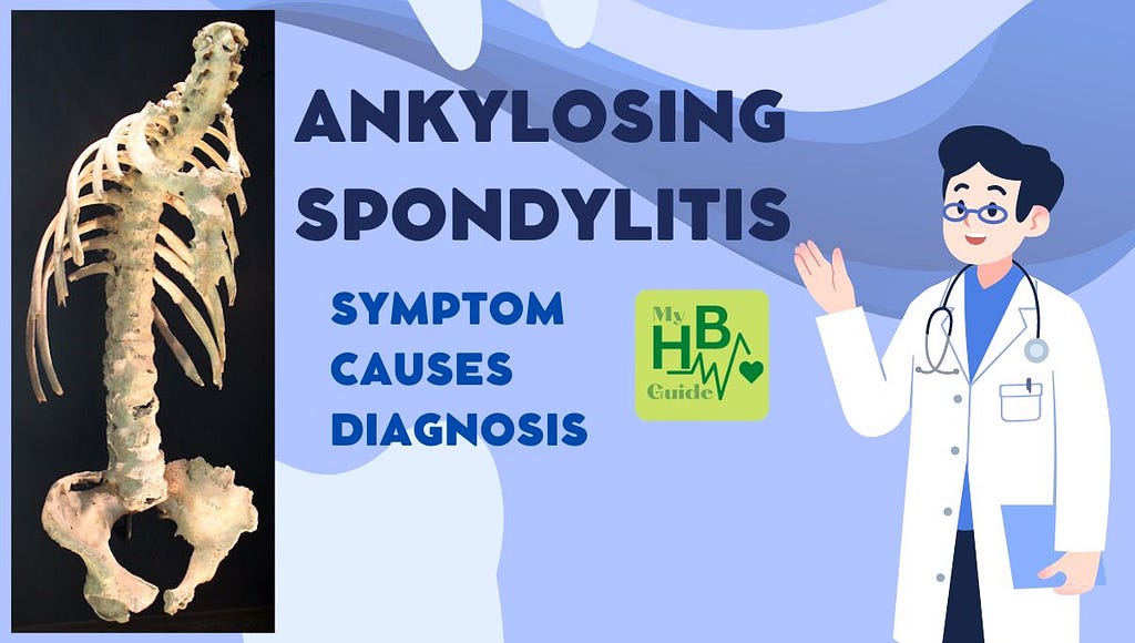 Ankylosing Spondylitis, Treatment, Symptom, Causes