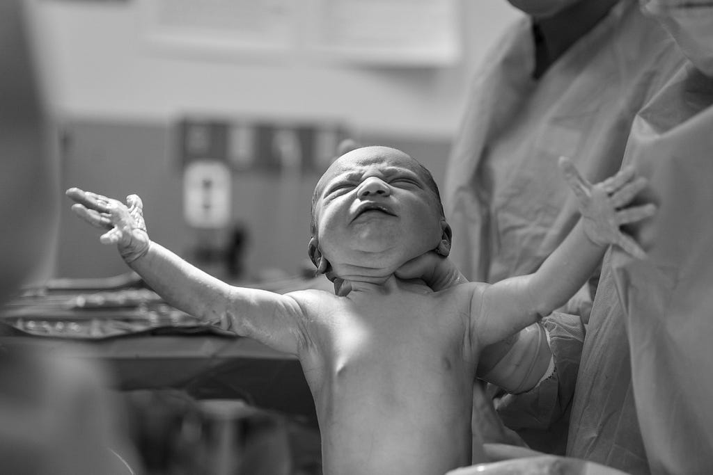 A newborn baby, arms outstretched and grimacing, being held by a doctor