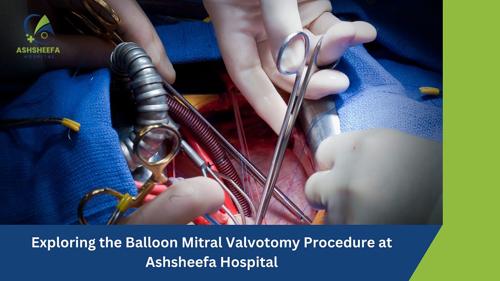 Balloon Mitral Valvotomy Procedure