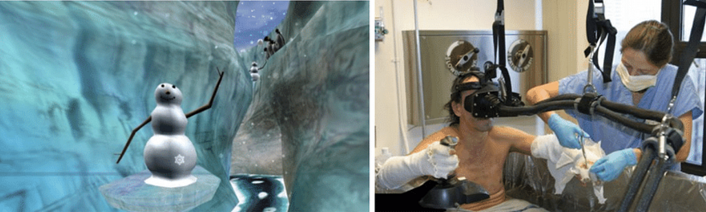 Side-by-side images showing screenshot from SnowWorld on the left (a snowy VR game environment with a snowman) , and a burn patient wearing a VR headset receiving wound care from a nurse on the right.