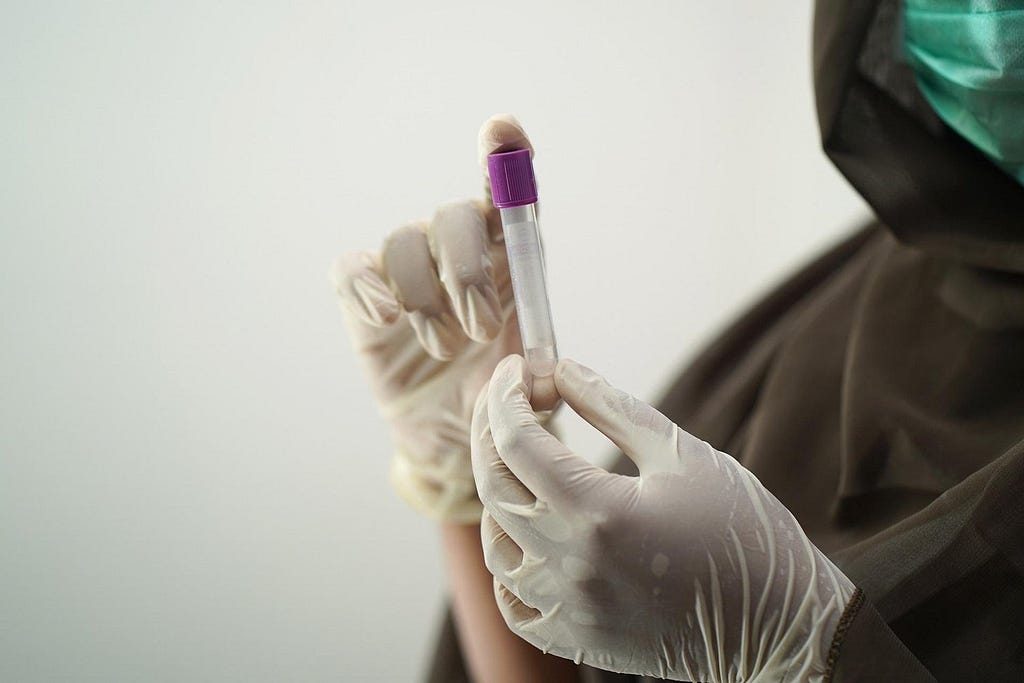 a nurse holds a plastic vial to take a fluid sample from a patient in a clean and safe way