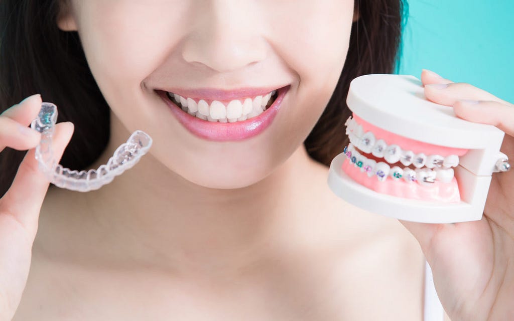 should I get Invisalign or braces, metal braces vs Invisalign, Invisalign vs Braces, Braces, Invisalign.