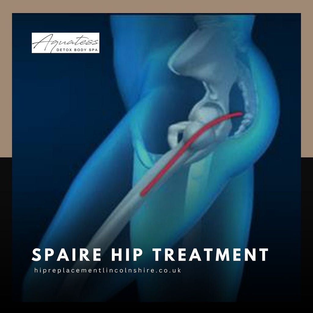 SPAIRE Hip Treatment
