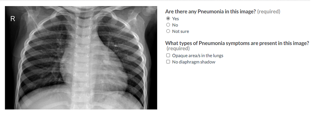A chest x-ray image on the left and two questions with different answer options on the right.