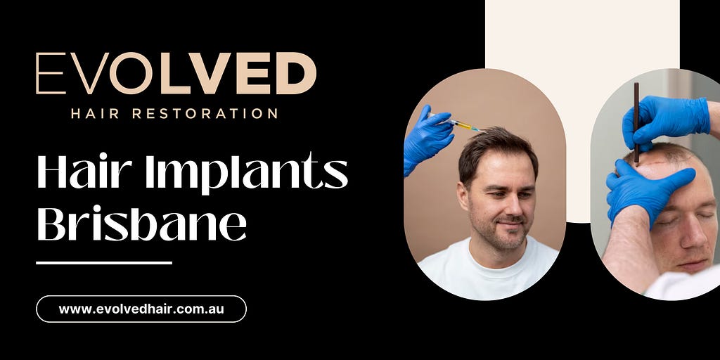 hair implants brisbane