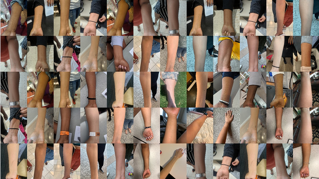 A collage of about 72 forearm photos documenting the various skin tones we talked to