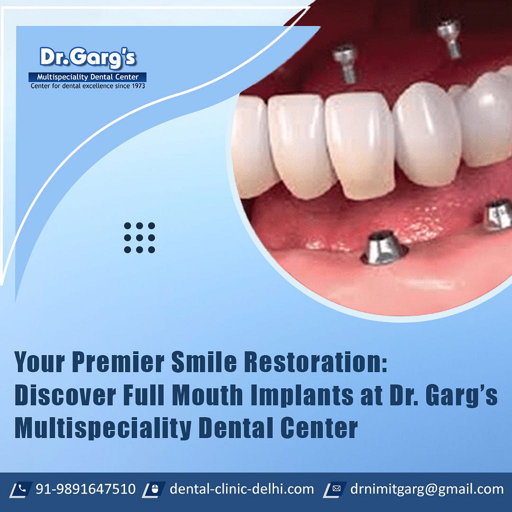 Your Premier Smile Restoration: Discover Full Mouth Implants at Dr. Garg’s Multispeciality Dental Center
