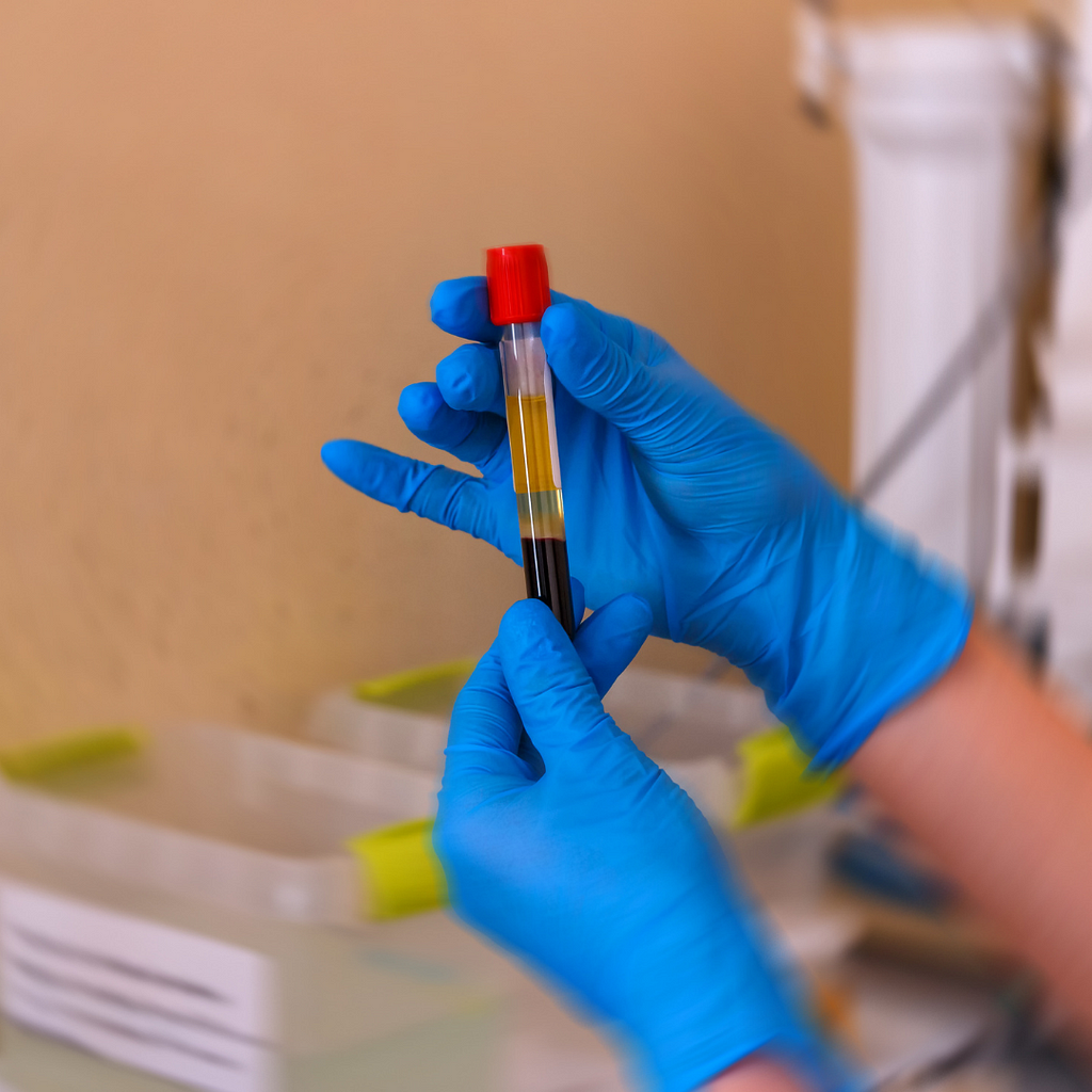 Two hands in blue latex gloves hold a tube containing a blood sample. Credit: Canva