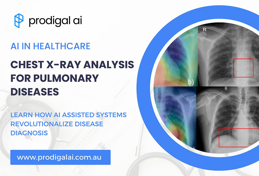 Revolutionizing Pulmonary Disease Diagnosis with AI-powered Chest X-ray Analysis | Prodigal AI