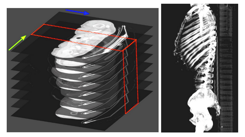 Two images side by side; the first shows a stack of chest CT scans in the axial plane with a red slice demonstrating how to re-slice the data for a different view; the second image shows what that view (sagittal) would look like of the spine.