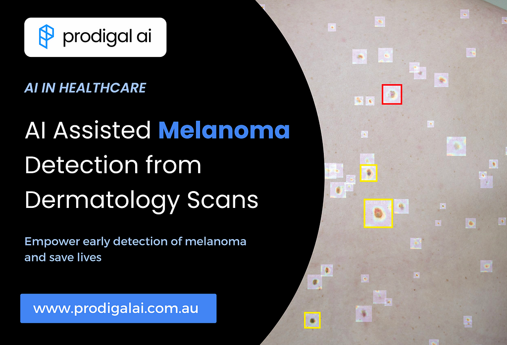 AI Revolutionizing Melanoma Detection from Dermatology Scans | Prodigal AI