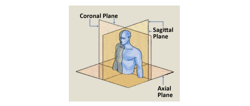 A graphic of a blue human torso and the coronal, sagittal, and axial planes.