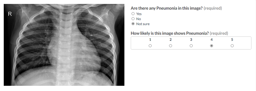 A chest x-ray image on the left and two questions with different answer options on the right.