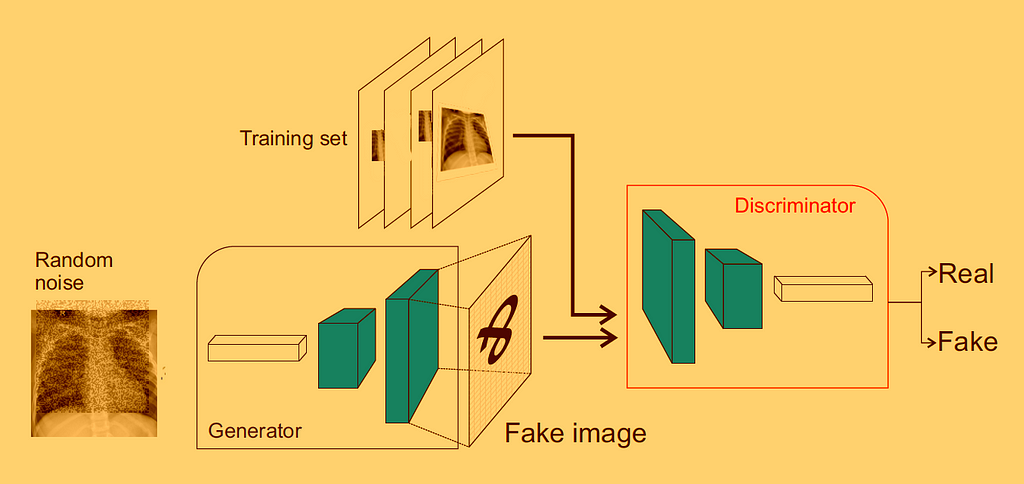 Generative Adversarial Networks for X-Rays