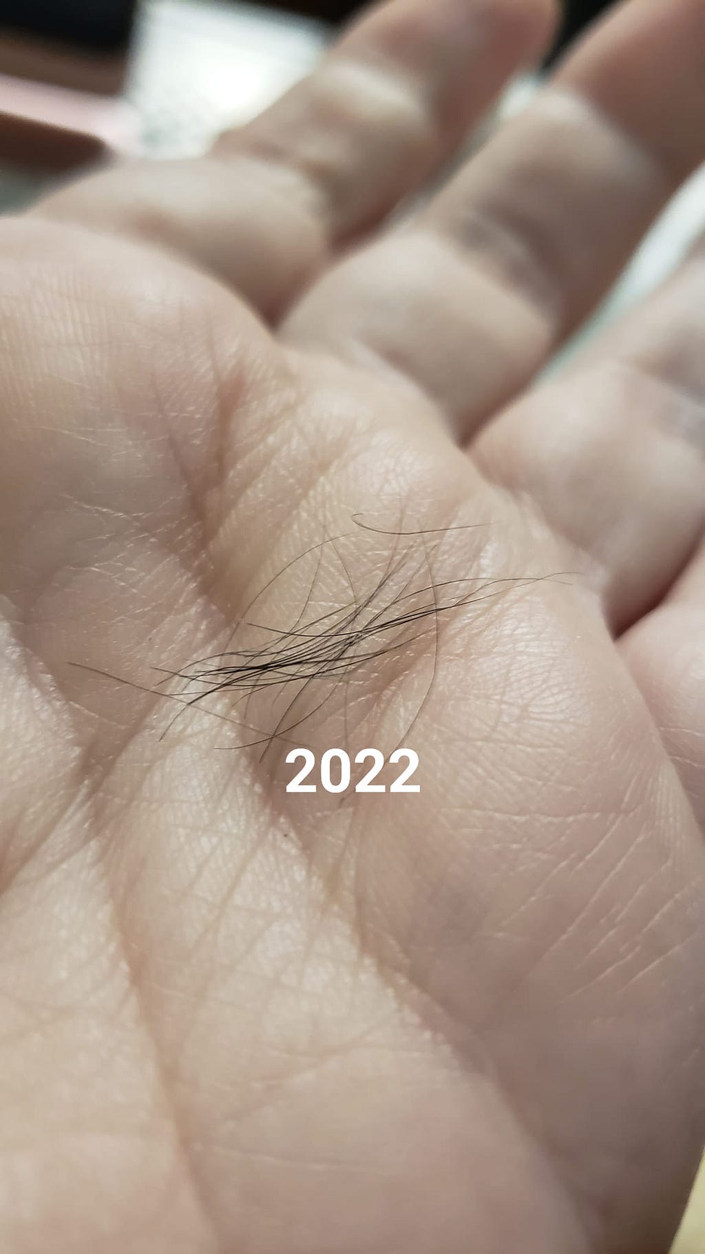 Photo of short hairs, less than an inch long, on a hand with the year “2022” written on the photo.