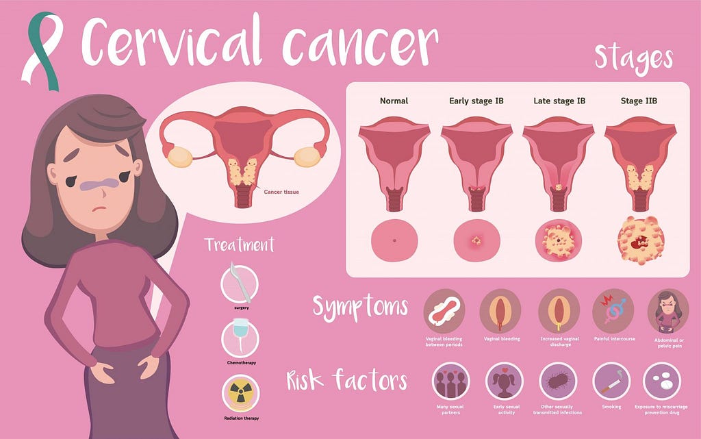 Causes of Cervical cancer