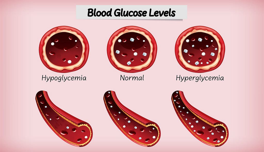 Hyperglycemia vs Hypoglycemia
