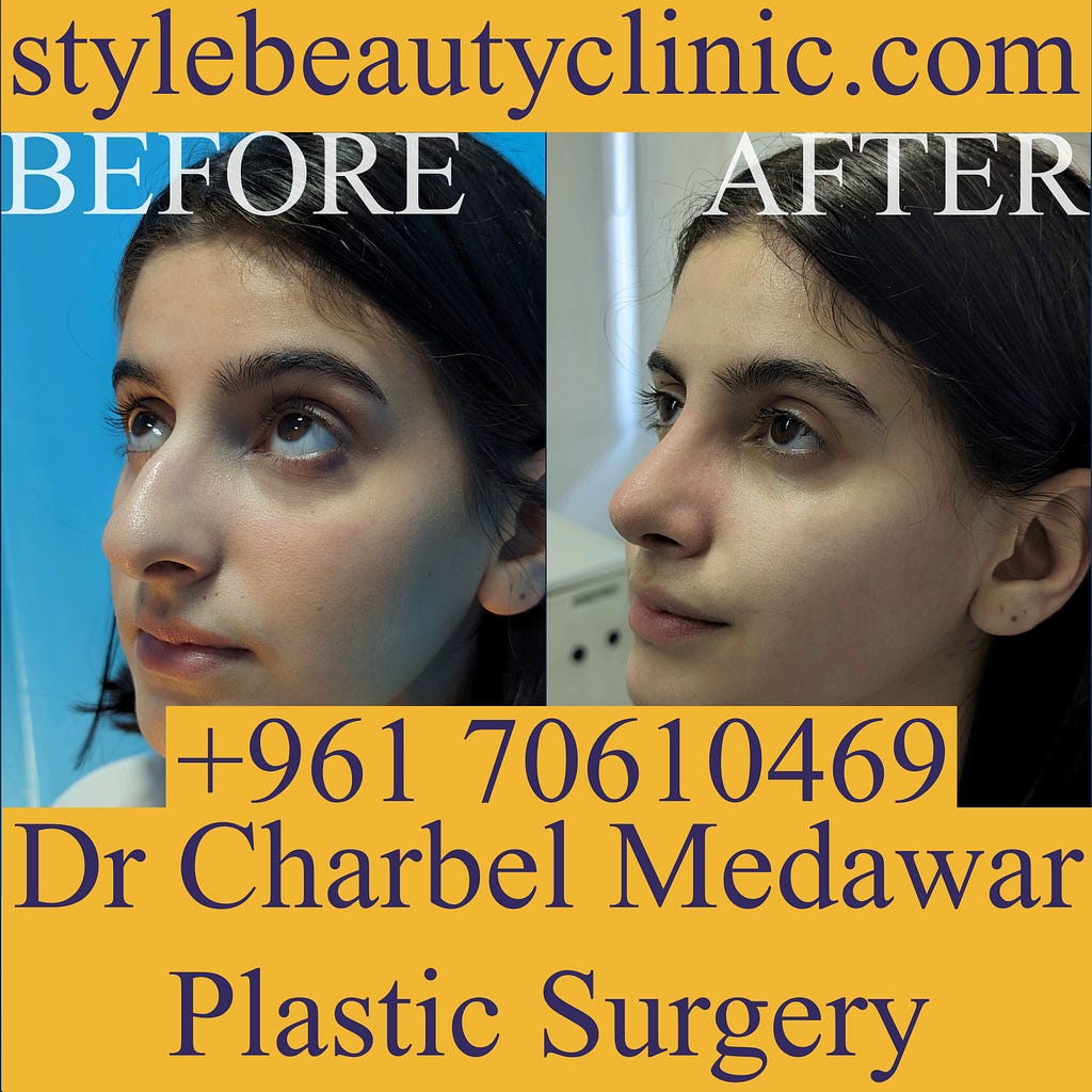 top nose plastic surgeon lebanon