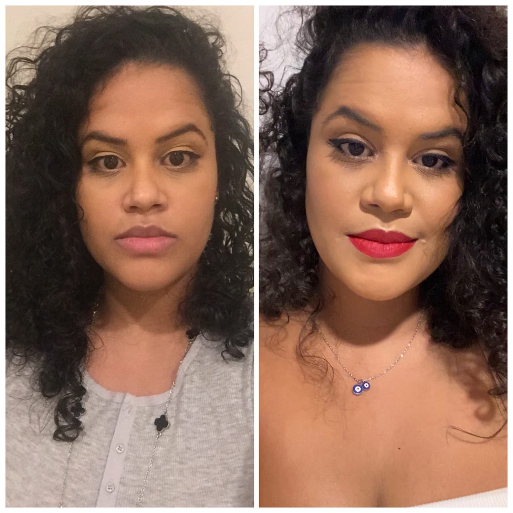 mulher em uma foto antes e após cirurgia ortognática