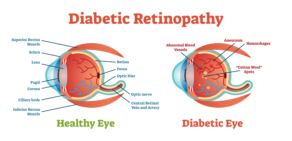 Medical Diagnosis with a Convolutional Neural Network