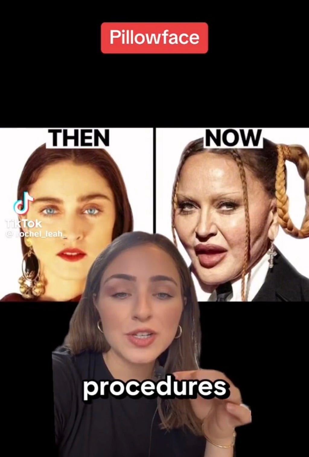 a split image of madonna when she was young and natural vs now with pillow face plastic surgery fillers injections