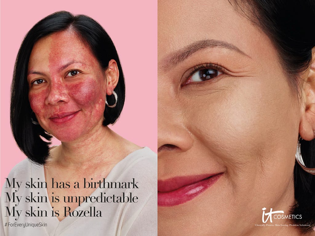 The first picture is of Rozella smiling — she wears hoop earrings and a soft-coloured top; her birthmark is radiantly visible; her hair is a short bob and dark. ‘My skin has a birthmark, My skin is unpredictable, My skin is Rozella. #ForEveryUniqueSkin’ is written on the picture. The second picture is a close-up picture of Rozella wearing an IT Cosmetics product. ‘IT Cosmetics’ is written on the picture.