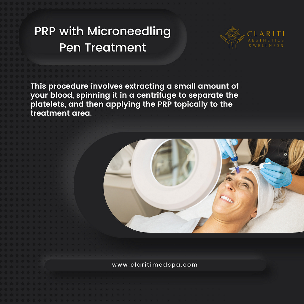 PRP with Microneedling Pen Treatment in Houston, TX