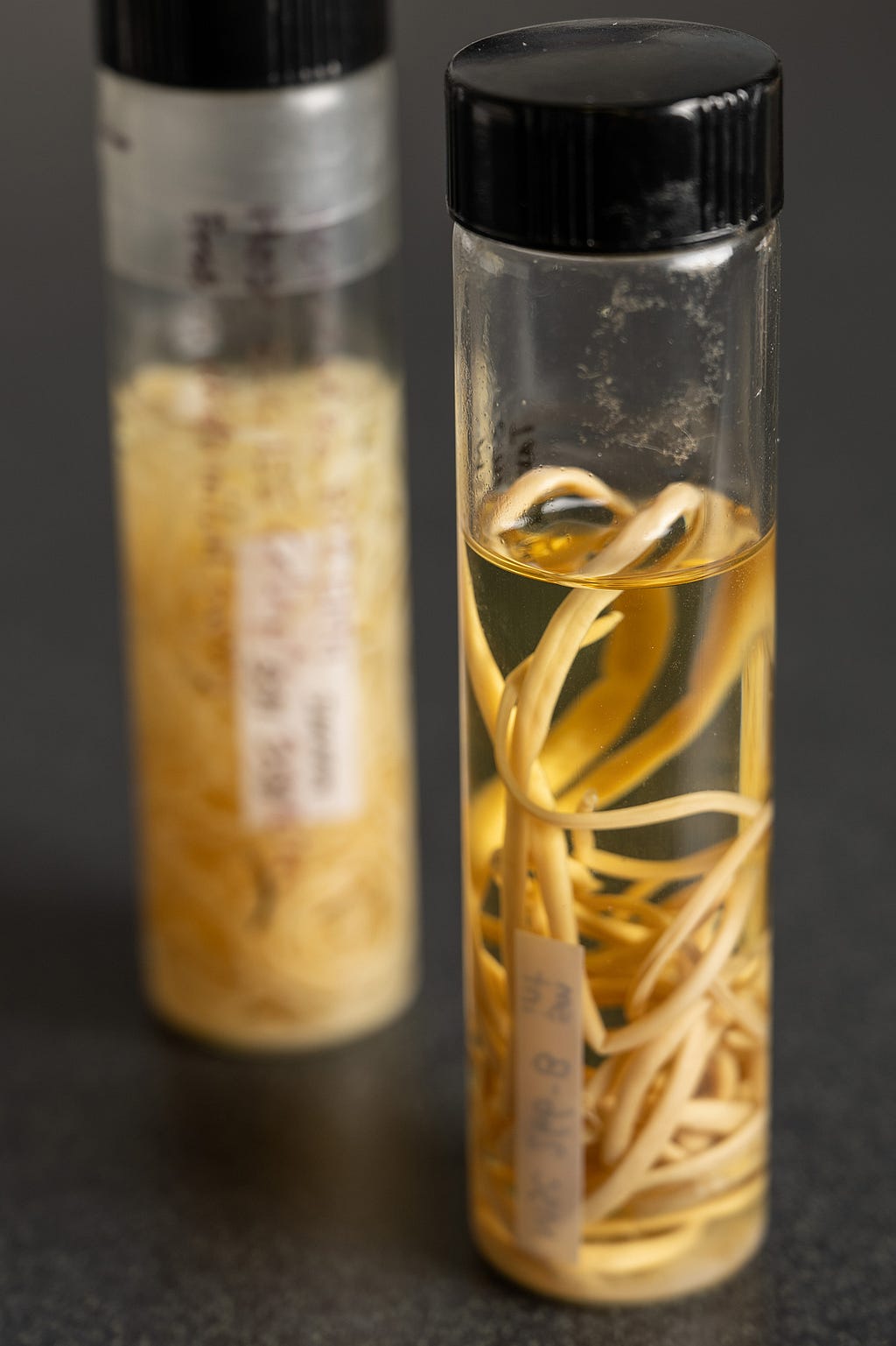 Pictures of yellow parasite worms in a jar.