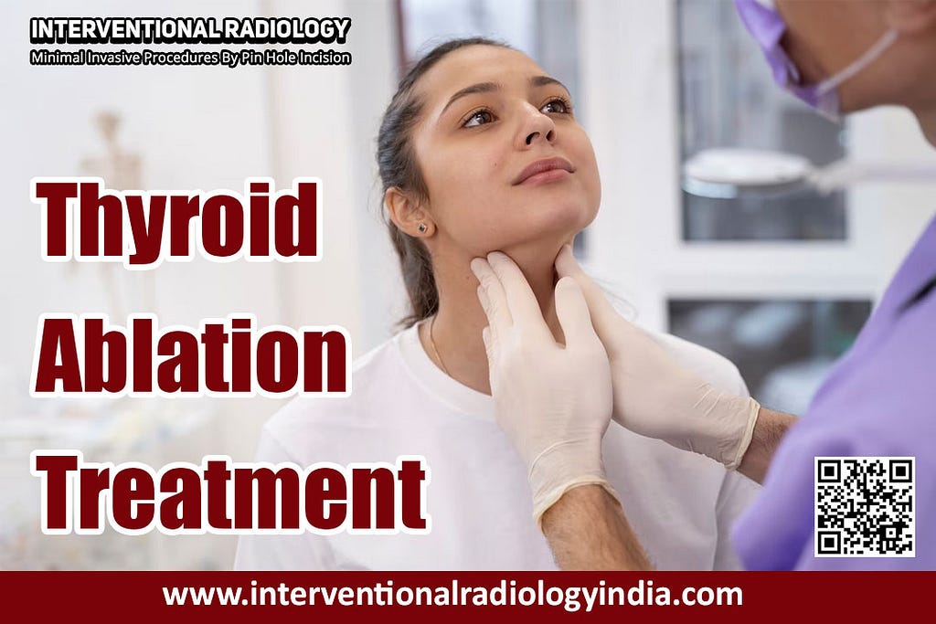 Thyroid Ablation Treatment in Delhi
