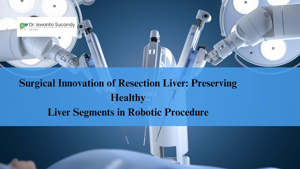 Preserving Healthy Liver Segments: Robotic Resection Surgery