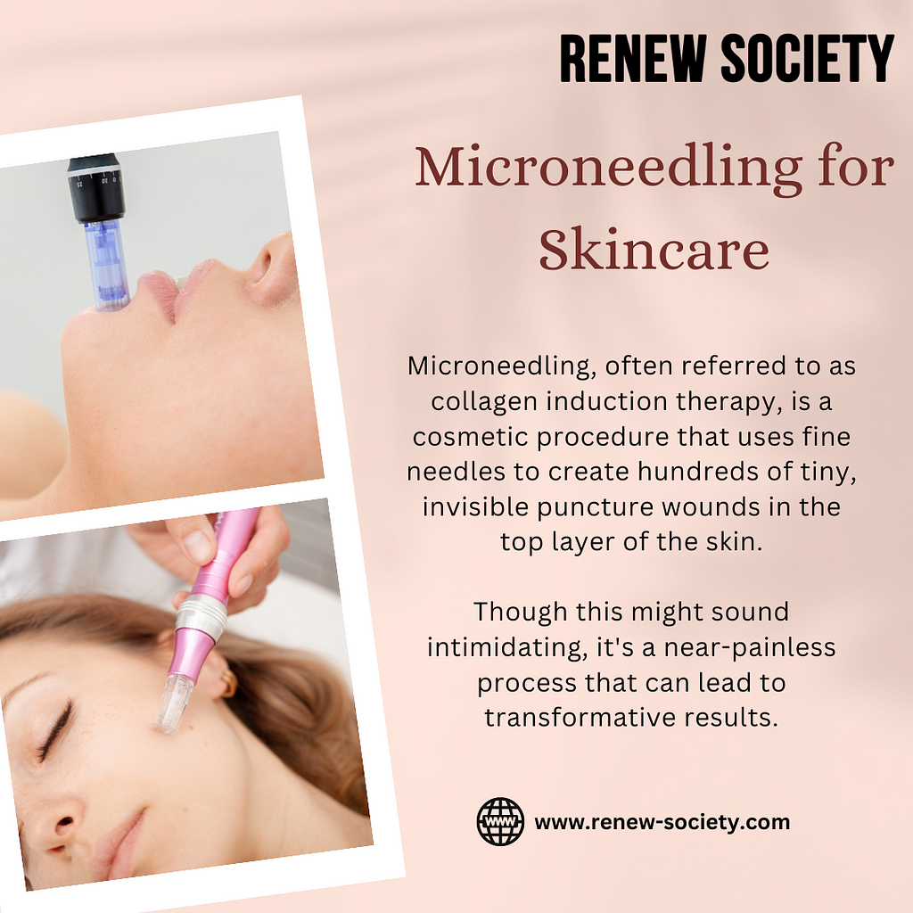 Microneedling for Skincare in McKinney, TX: