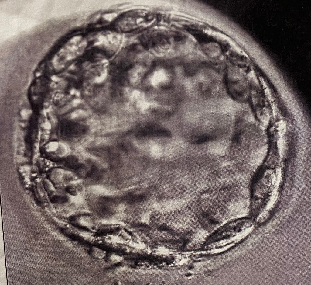 A black and white image of a round collection of cells