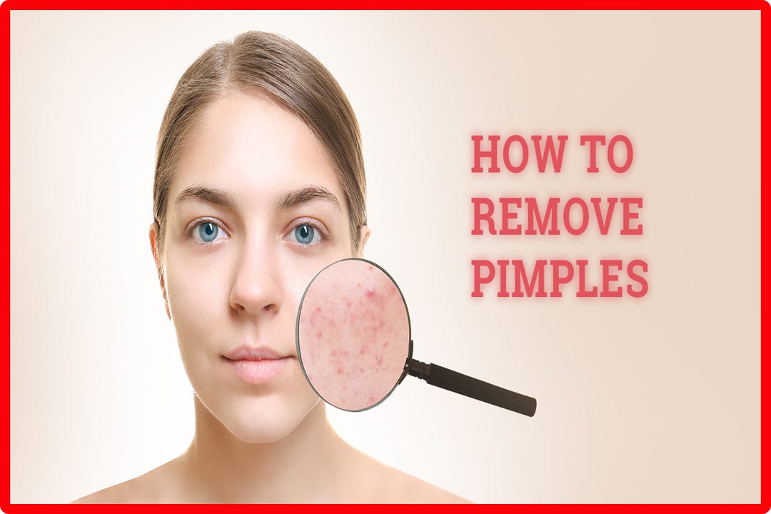 Acne is a very common skin condition that can affect people of all ages