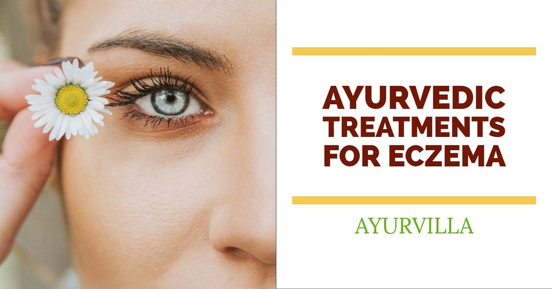 Ayurvedic Treatment For Eczema