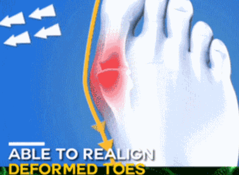 Best fashionable shoes or sandals for bunions feet
